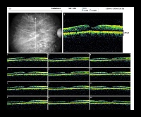 RADIAL LINES OD.jpg